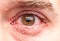 Red Eyes
